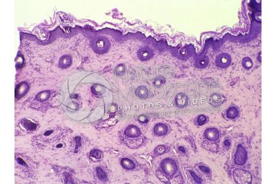 Man. Scalp. Transverse section. 32X
