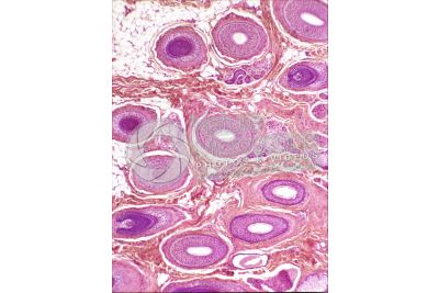 Man. Scalp. Transverse section. 64X