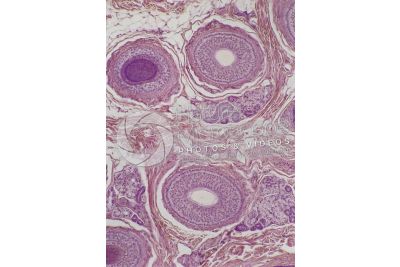 Man. Scalp. Transverse section. 125X