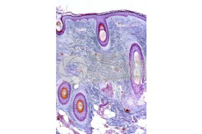 Man. Scalp. Transverse section. 64X