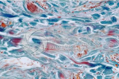 Man. Scalp. Oblique section. 400X