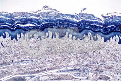 Man. Skin and epidermis. Vertical section. 40X