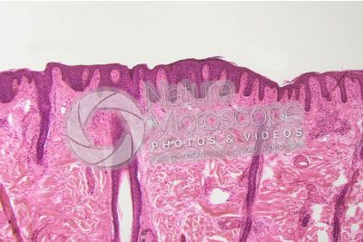 Man. Skin and epidermis. Vertical section. 100X