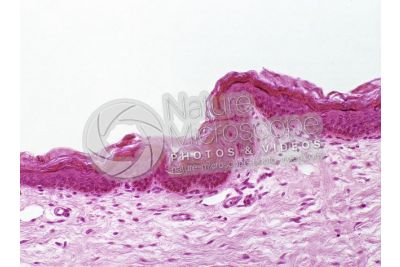 Man. Skin and epidermis. Vertical section. 200X