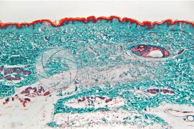 Man. Skin and epidermis. Vertical section. 32X