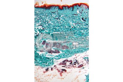 Man. Skin and epidermis. Vertical section. 64X