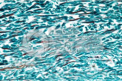 Man. Skin and epidermis. Vertical section. 250X