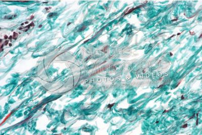 Man. Skin and epidermis. Vertical section. 250X