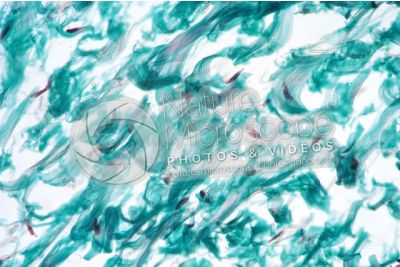 Man. Skin and epidermis. Vertical section. 250X