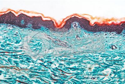 Man. Skin and epidermis. Vertical section. 125X