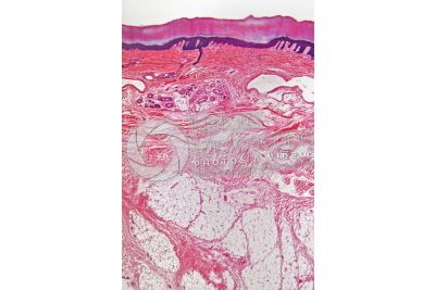 Man. Skin and epidermis. Vertical section. 32X