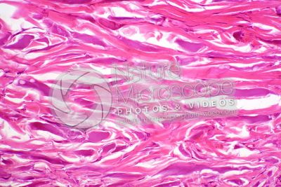 Man. Skin and epidermis. Vertical section. 250X