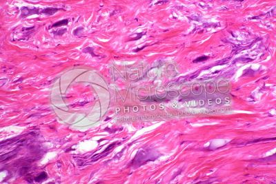 Man. Skin and epidermis. Vertical section. 250X