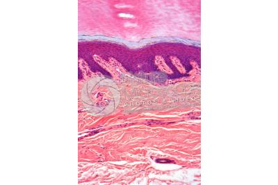 Man. Skin and epidermis. Vertical section. 100X