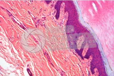 Man. Skin and epidermis. Vertical section. 100X