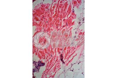 Man. Skin and epidermis. Vertical section. 125X