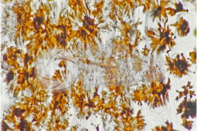 Man. Melanocytes. 100X
