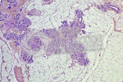 Woman. Inactive mammary gland. Vertical section. 32X