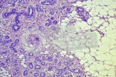 Woman. Inactive mammary gland. Vertical section. 100X