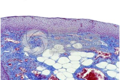 Mammal. Esophagus. Transverse section. 100X