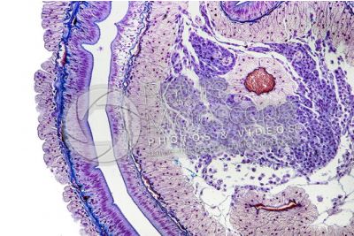 Lumbricus sp. Earthworm. Lumbricidae. Transverse section. 125X
