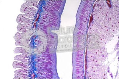 Lumbricus sp. Earthworm. Lumbricidae. Transverse section. 250X