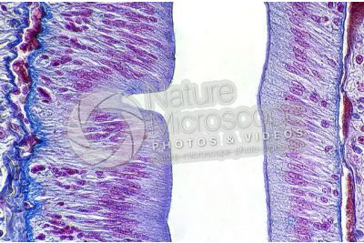 Lumbricus sp. Earthworm. Lumbricidae. Transverse section. 500X