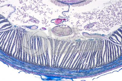 Lumbricus sp. Earthworm. Lumbricidae. Transverse section. 125X