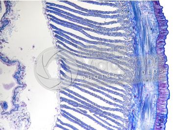 Lumbricus sp. Earthworm. Lumbricidae. Transverse section. 125X