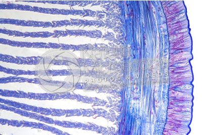 Lumbricus sp. Earthworm. Lumbricidae. Transverse section. 250X