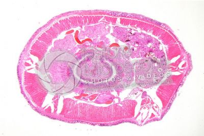 Lumbricus sp. Earthworm. Lumbricidae. Transverse section. 32X