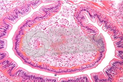 Lumbricus sp. Earthworm. Lumbricidae. Transverse section. 125X