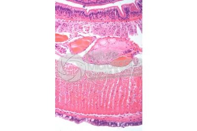 Lumbricus sp. Earthworm. Lumbricidae. Transverse section. 250X
