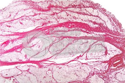 Mammal. Unilocular adipose tissue. Transverse section. 32X