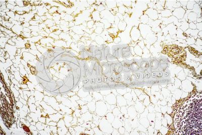 Mammal. Unilocular adipose tissue. Transverse section. 40X