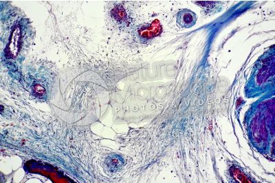 Mammal. Unilocular adipose tissue. Transverse section. 125X