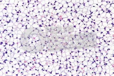 Rat. Unilocular adipose tissue. Transverse section. 125X