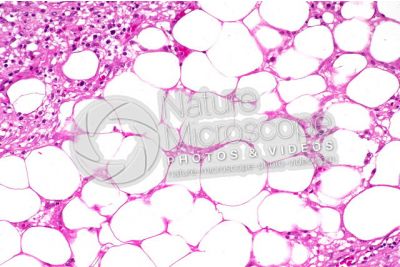 Rat. Unilocular adipose tissue. Transverse section. 250X