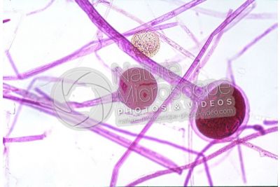 Rhizopus sp. Muffa del pane. Fungo saprofita. 100X