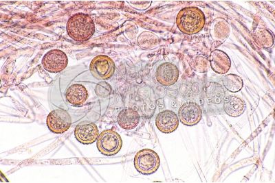Rhizopus sp. Muffa del pane. Fungo saprofita. 250X