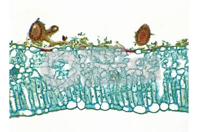 Ampelomyces quisqualis. Fungo iperparassita. Sezione longitudinale. 100X