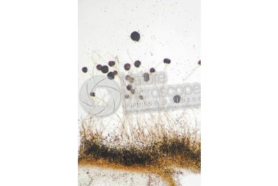 Aspergillus sp. Muffa. Fungo saprofita. Conidioforo. 64X