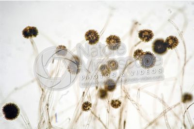 Aspergillus sp. Muffa. Fungo saprofita. Conidioforo. 100X
