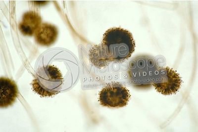 Aspergillus sp. Muffa. Fungo saprofita. Conidioforo. 250X
