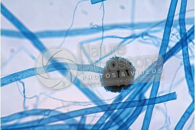 Aspergillus sp. Muffa. Fungo saprofita. Conidioforo. 250X