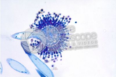 Aspergillus sp. Muffa. Fungo saprofita. Conidioforo. 400X