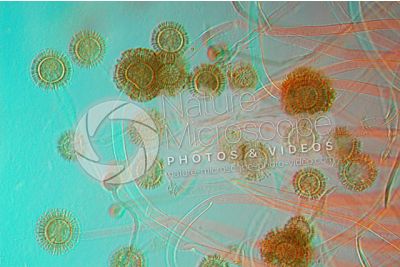 Aspergillus sp. Muffa. Fungo saprofita. Conidioforo. Colorazione di contrasto. 125X