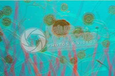 Aspergillus sp. Muffa. Fungo saprofita. Conidioforo. Colorazione di contrasto. 125X