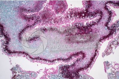 Claviceps purpurea. Ergot. Fungo parassita. Sezione longitudinale. 125X