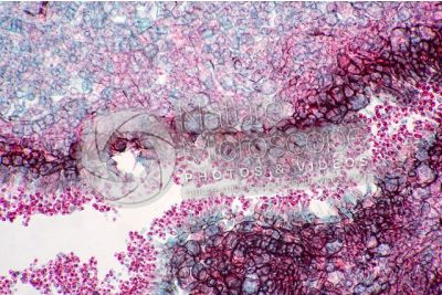 Claviceps purpurea. Ergot. Fungo parassita. Sezione longitudinale. 500X
